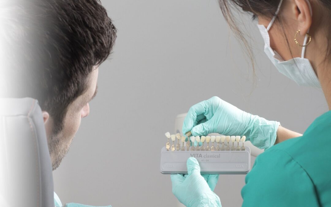 Branqueamento dentário: no consultório ou em casa?