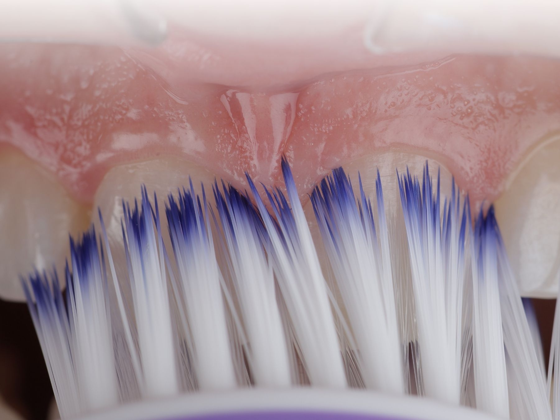 ngo-illustration-Artboard 5 10 erreurs que vous faites en vous brossant les dents Confident