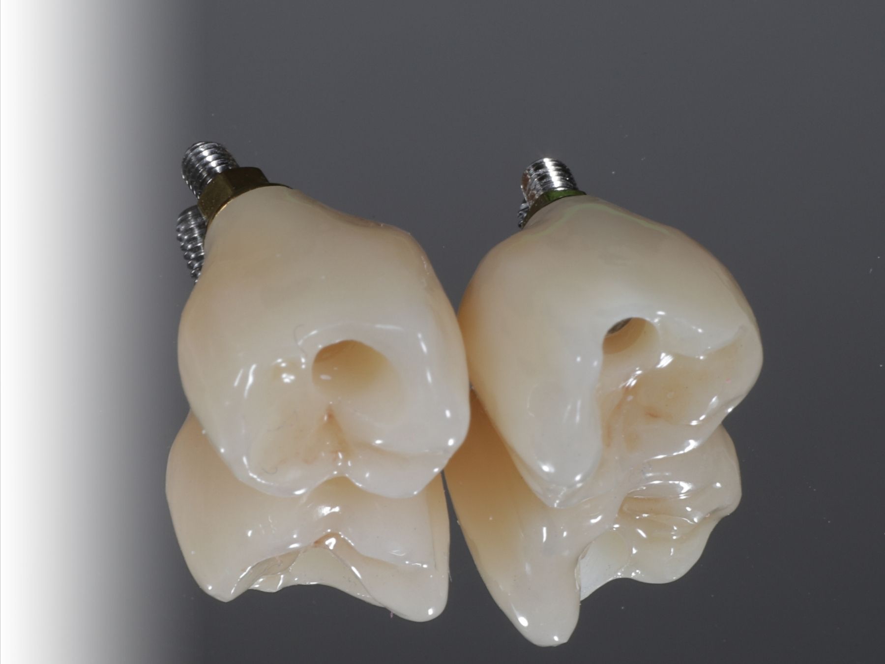 Combien coûte un implant dentaire en Suisse ?